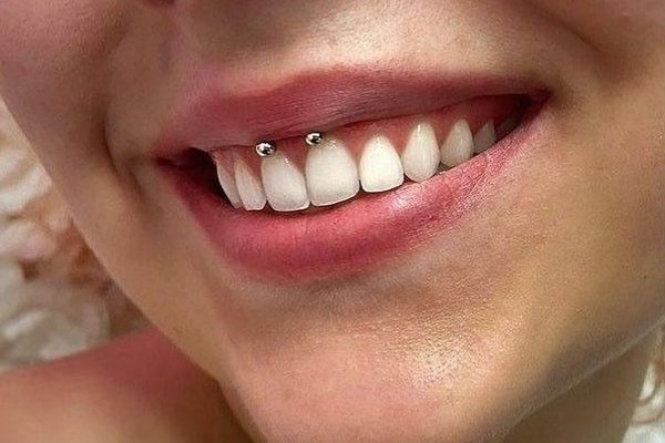 smiley piercing pros and cons