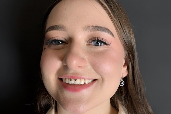 smiley piercing pros and cons