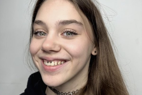 smiley piercing pros and cons