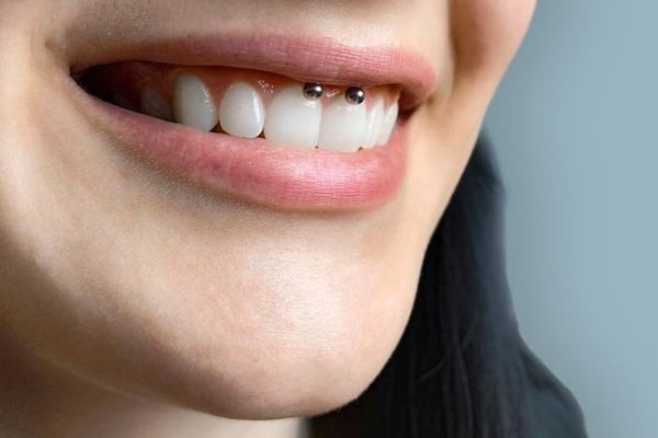 smiley piercing pros and cons