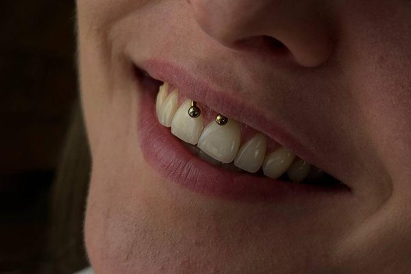 smiley piercing pros and cons