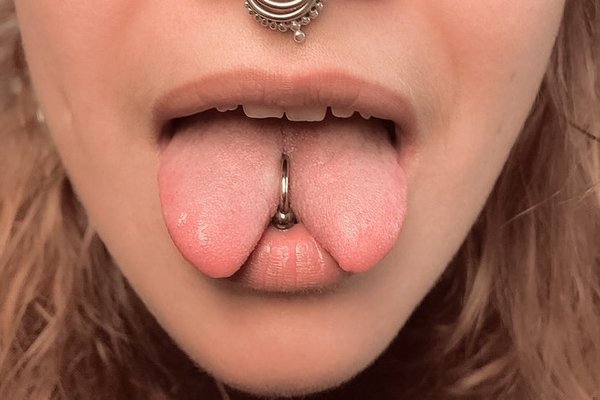 Tongue splitting