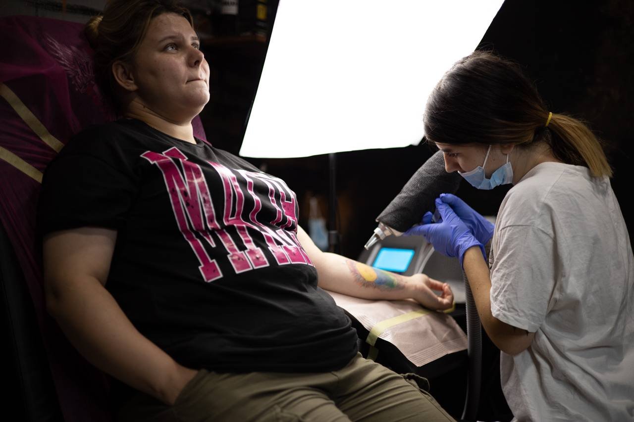 Tattoo removal in Wolverhampton