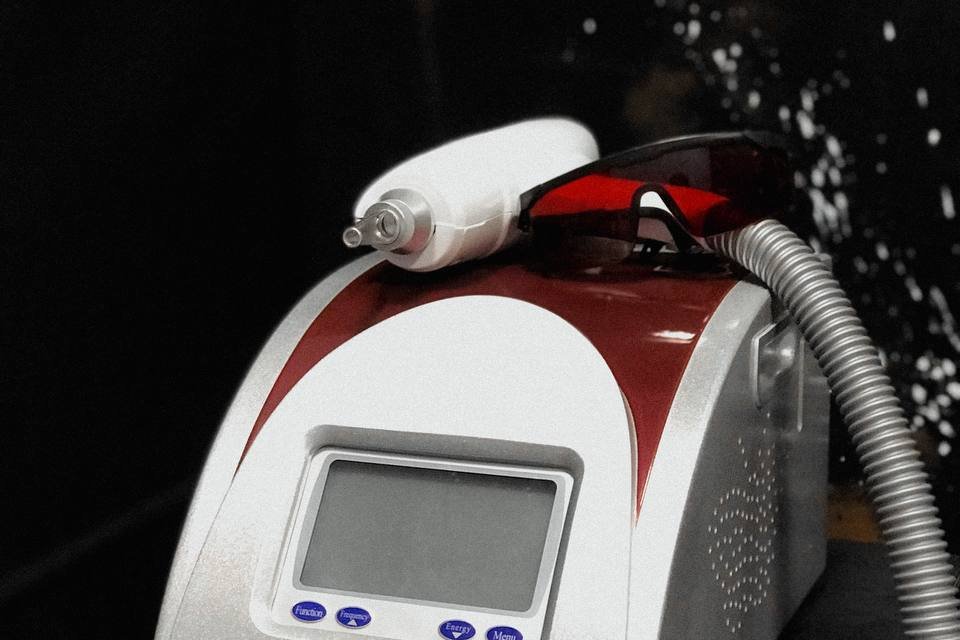 Tattoo removal in Wolverhampton