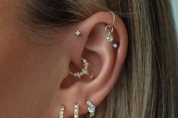 Close-up of vertical helix piercing after healing