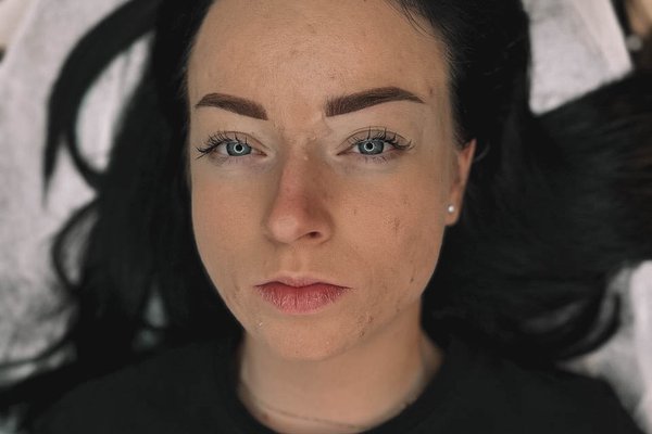 eyebrow feathering healing process