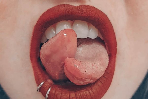 Tongue splitting